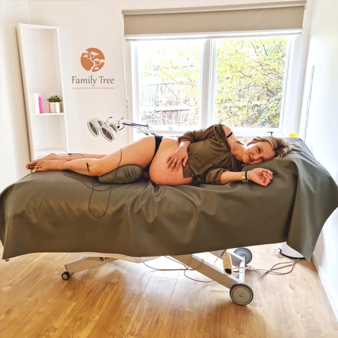 pregnancy acupuncture